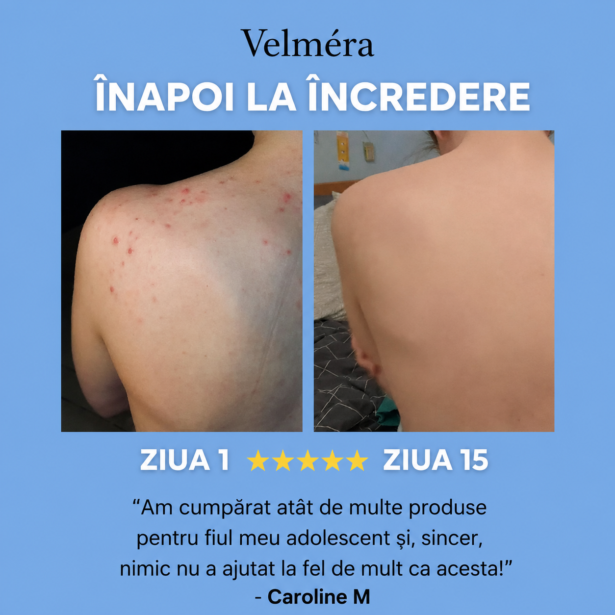 Bacne Out Bar